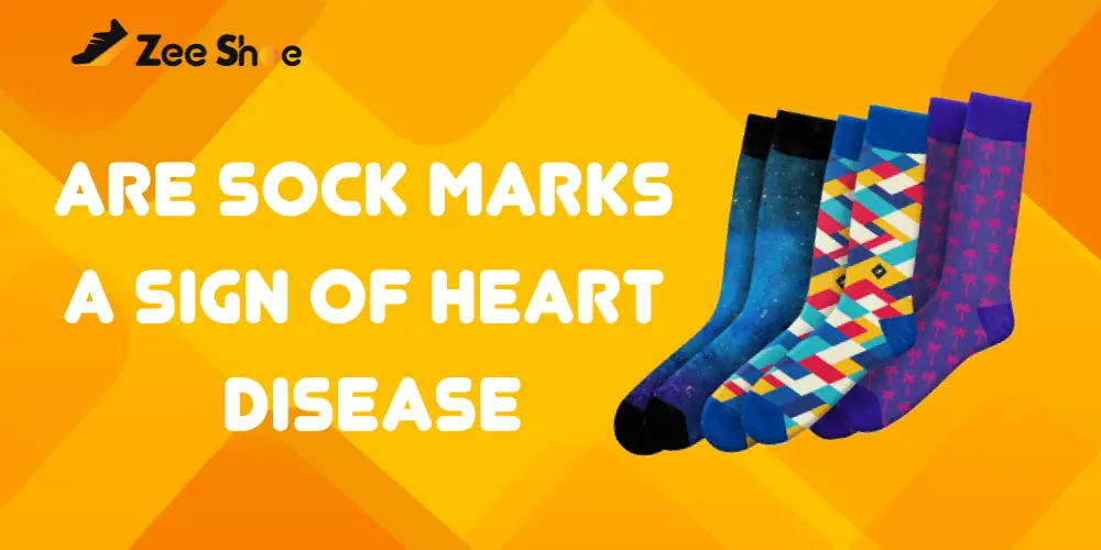 Are sock marks a sign of heart disease